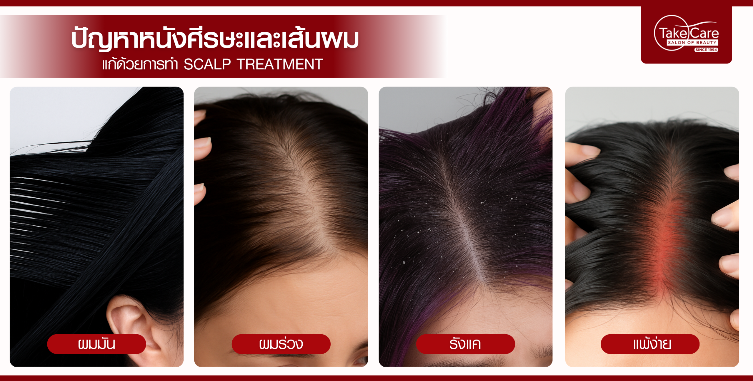 รังแค ผมร่วง ผมมัน ผมบาง? ฟื้นรากผมลึกถึงหนังศีรษะ ที่ Take Care สุขุมวิท 35